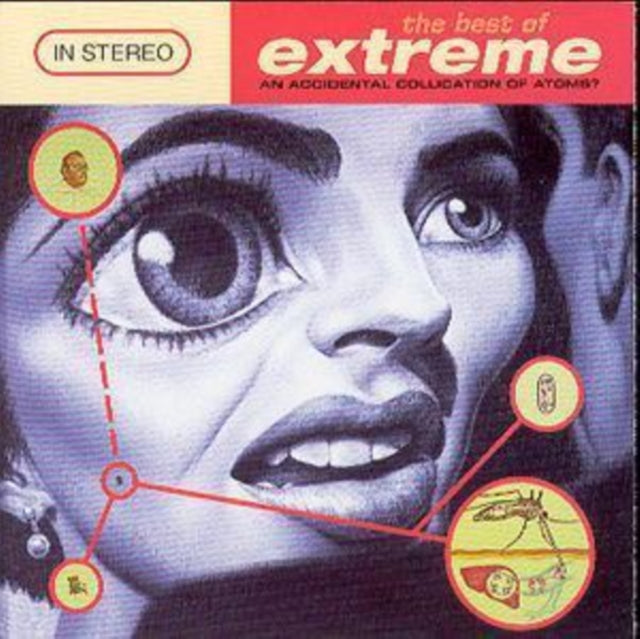 The Best Of Extreme An Accidental Collic