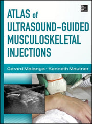 Atlas Of Ultrasound Guided Musculo By Malanga, Gerard