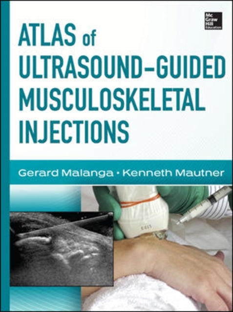 Atlas Of Ultrasound Guided Musculo By Malanga, Gerard