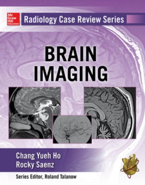 Radiology Case Review Series