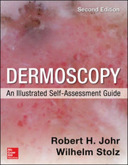 Dermoscopy An Illustrated Self Assessm