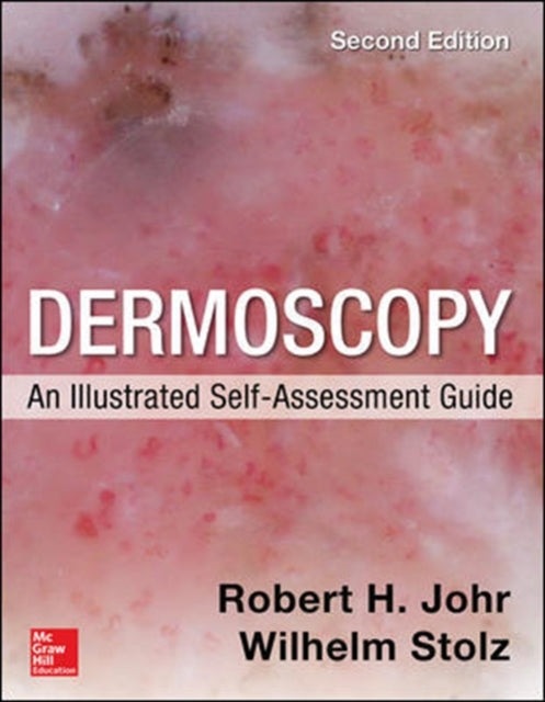 Dermoscopy An Illustrated Self Assessm