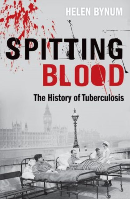 Spitting Blood The History/tuberculosis By Bynum, Helen
