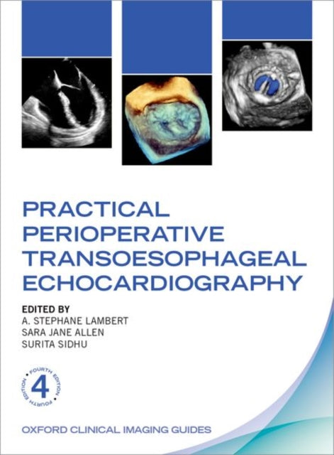 Practical Perioperative Transoesophagea