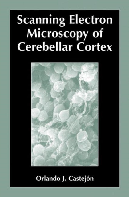 Scanning Electron Microscopy Of Cerebell