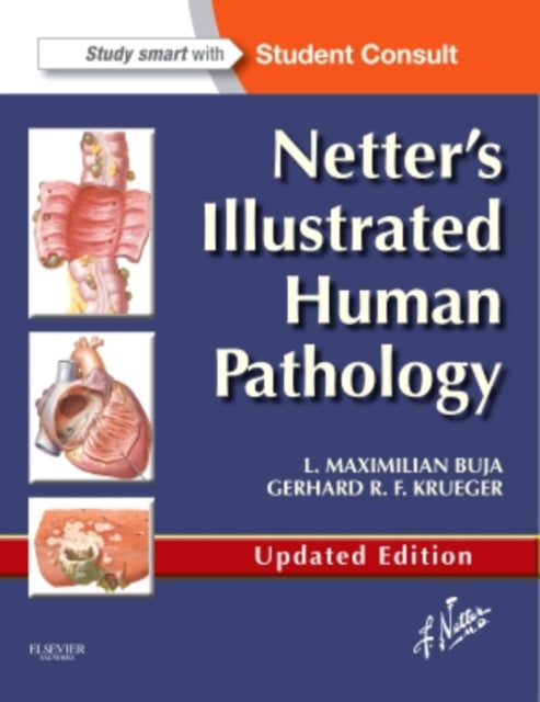 Netter S Illustrated Human Pathology Up