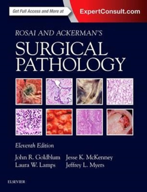 Rosai & Ackermans Surgical Pathology