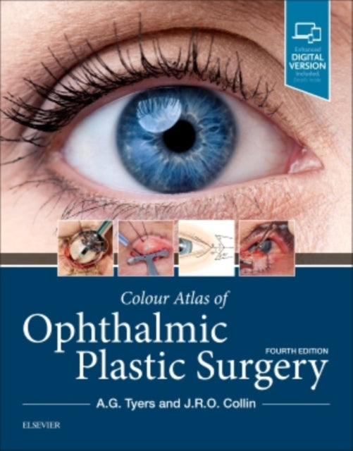 Colour Atlas Of Ophthalmic Plastic Surge