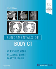 Fundamentals Of Body Ct By Richard Webb, W.