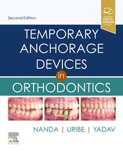 Temporary Anchorage Devices In Orthodon