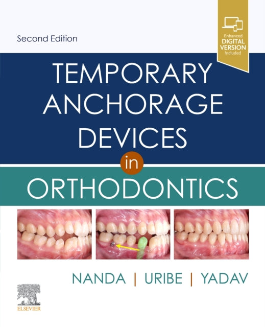 Temporary Anchorage Devices In Orthodon