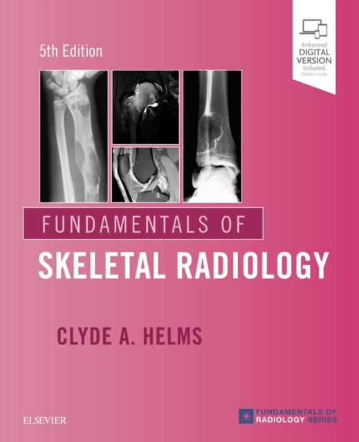 Fundamentals Of Skeletal Radiology By Helms, Clyde