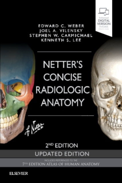 Netters Concise Radiologic Anatomy Upd