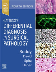 Gattusos Differential Diagnosis In Surgi