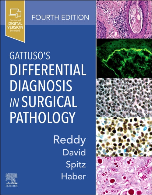 Gattusos Differential Diagnosis In Surgi