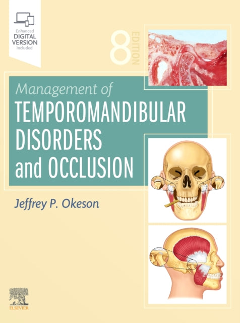 Management Of Temporomandibular Disorde