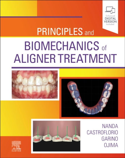 Principles And Biomechanics Of Aligner