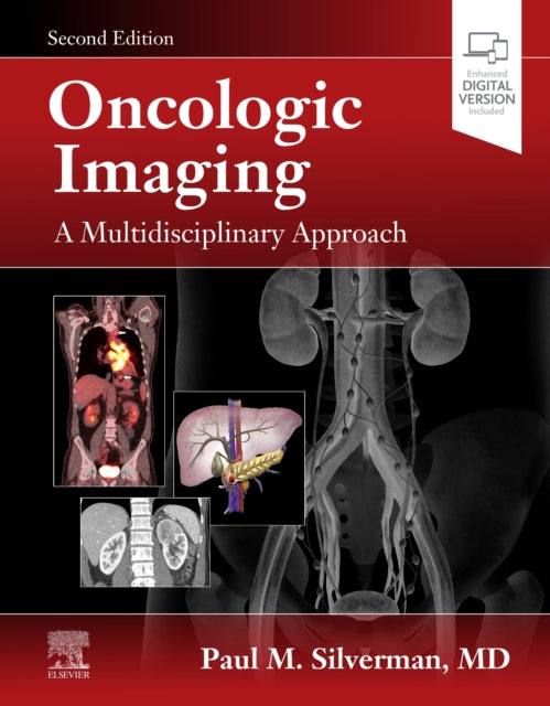 Oncologic Imaging A Multidisciplinary Ap