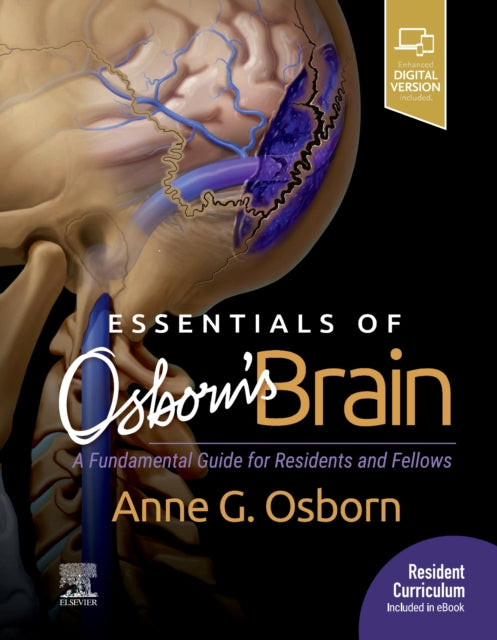 Essentials Of Osborns Brain A Fundamenta
