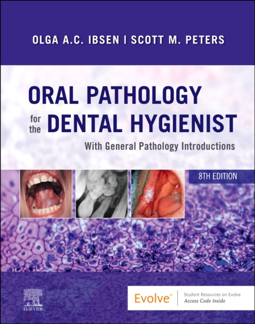 Oral Pathology For The Dental Hygienist By Ibsen, Olga A. C.
