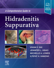 Comprehensive Guide To Hidradenitis Supp