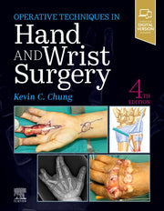 Operative Techniques Hand & Wrist Surger