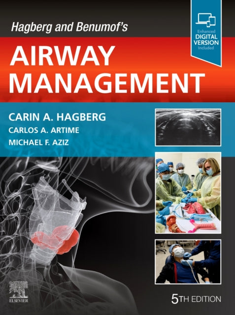 Hagberg & Benumofs Airway Management