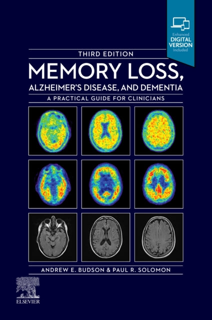 Memory Loss Alzheimers Disease & Dementi