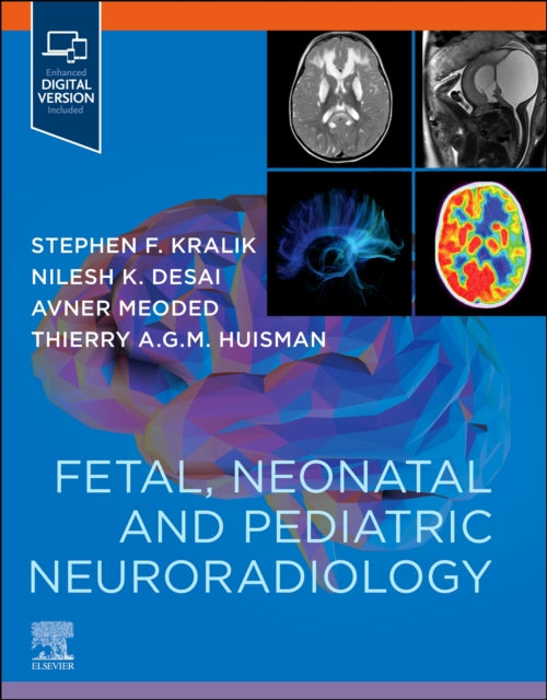 Fetal Neonatal & Pediatric Neuroradiolog