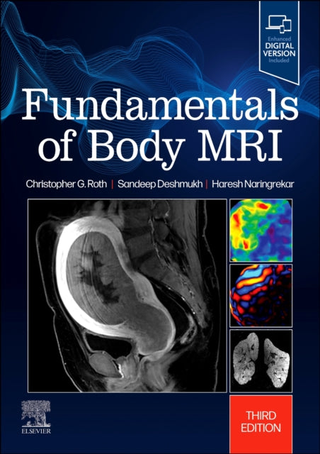 Fundamentals Of Body Mri