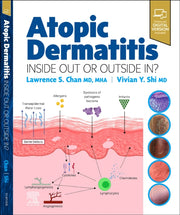 Atopic Dermatitis Inside Out Or Outside