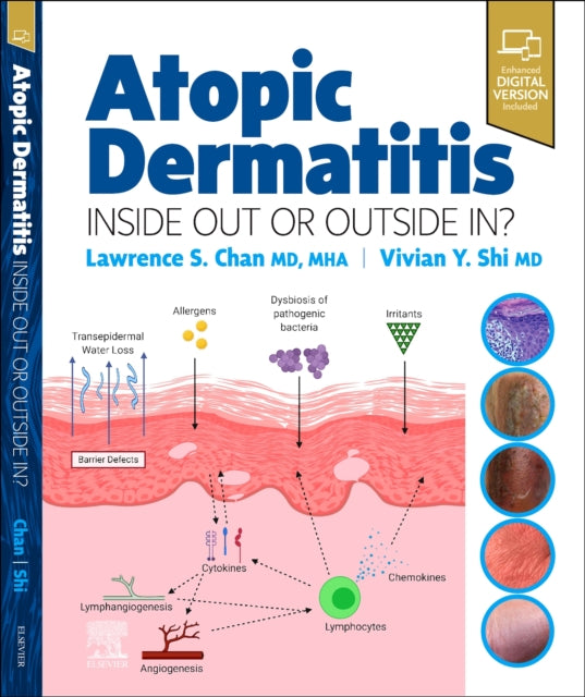 Atopic Dermatitis Inside Out Or Outside