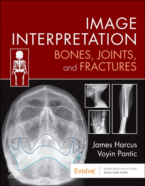 Image Interpretation Bones Joints & Frac