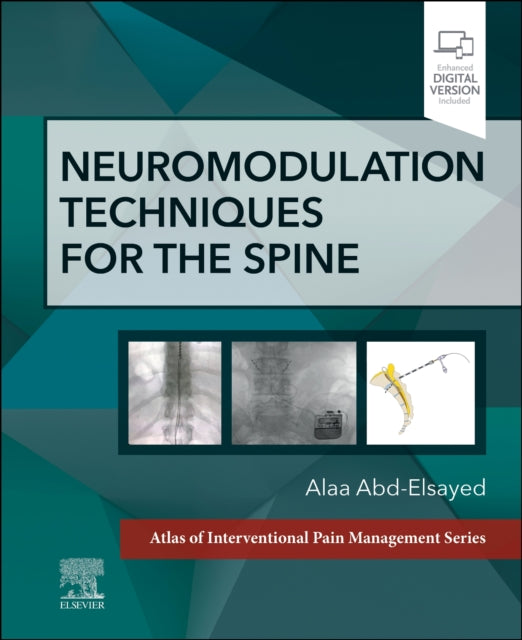 Neuromodulation Techniques For The Spine By Abd-elsayed, Alaa