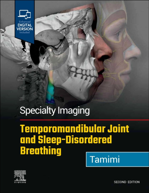 Specialty Imaging Temporomandibular Join