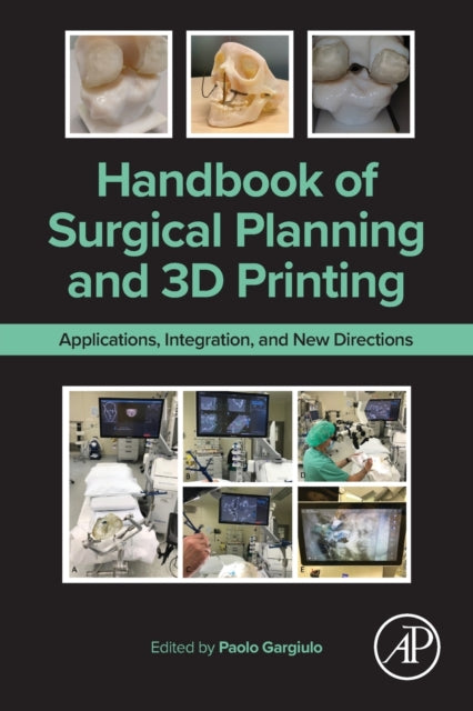 Handbook Of Surgical Planning & 3d Print