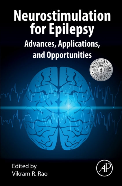 Neurostimulation For Epilepsy