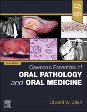 Cawsons Essentials Of Oral Pathology & O