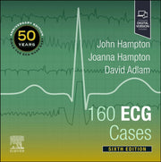 160 Ecg Cases