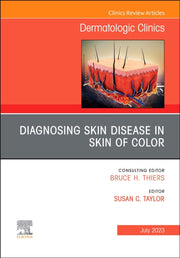 Diagnosing Skin Disease In Skin Of Color
