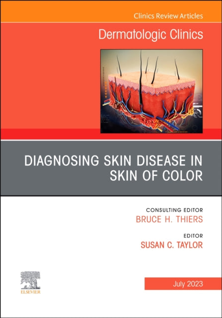 Diagnosing Skin Disease In Skin Of Color