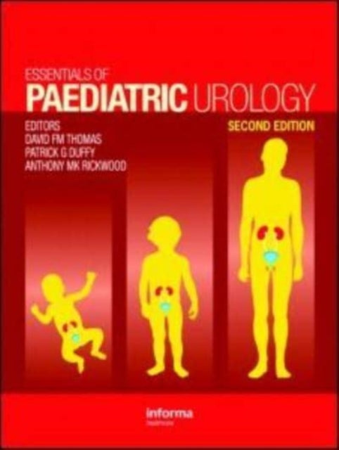 Essentials Of Paediatric Urology