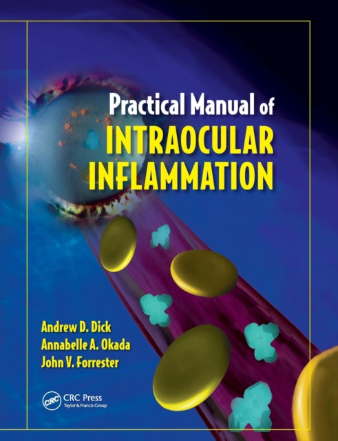 Practical Manual Of Intraocular Inflamma