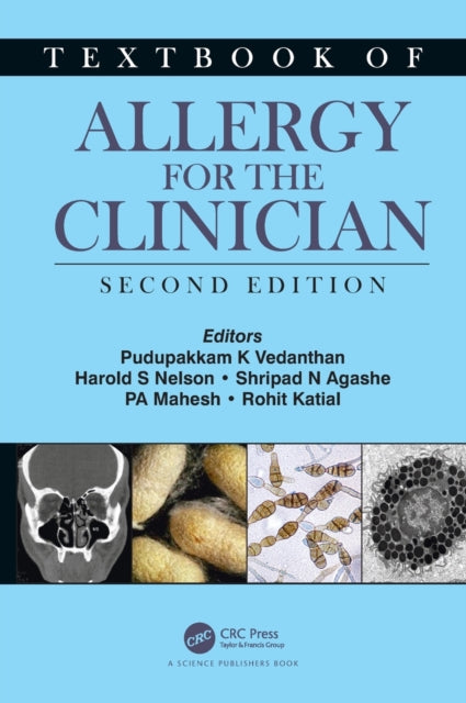 Textbook Of Allergy For The Clinician Se