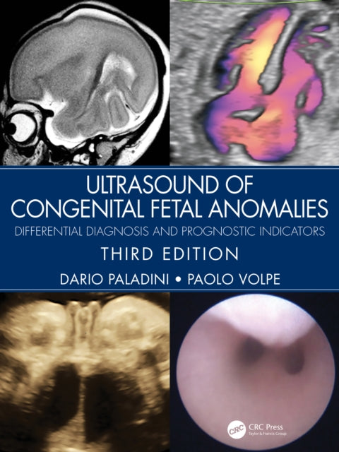 Ultrasound Of Congenital Fetal Anomalies By Paladini, Dario