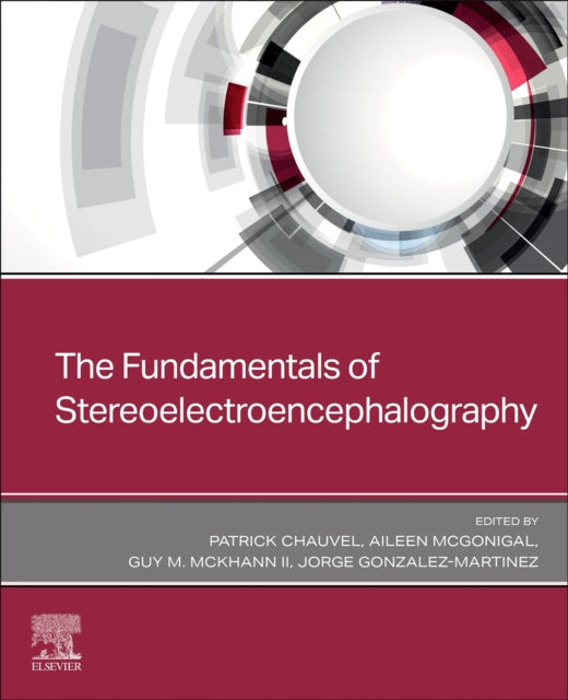 Stereoelectroencephalography