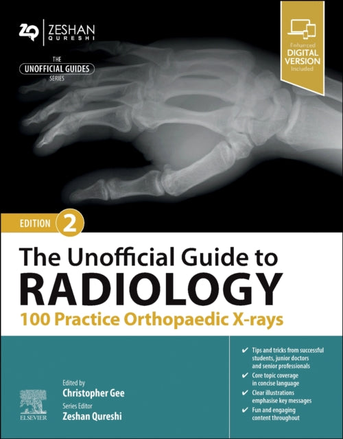 Unofficial Guide To Radiology 100 Practi