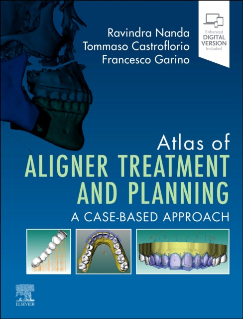 Atlas Of Aligner Treatment & Planning By Nanda,ravindra
