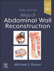 Atlas Of Abdominal Wall Reconstruction By Rosen,michael J.