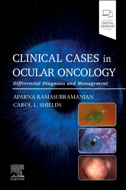 Clinical Cases In Ocular Oncology